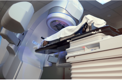 Stereotactic Body Radiation Therapy 