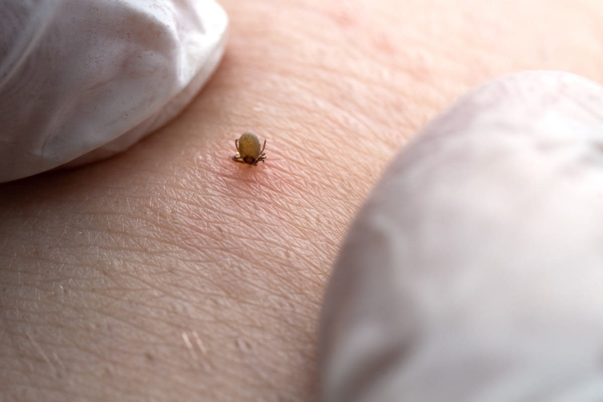 Tick on arm